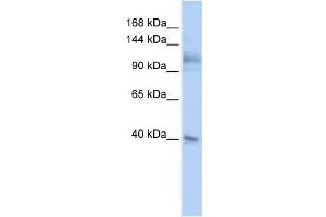 MSH2 antibody used at 1 ug/ml to detect target protein. (MSH2 anticorps)