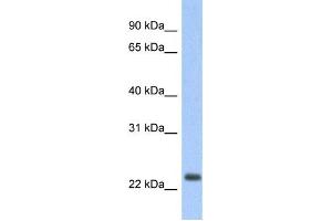 Western Blotting (WB) image for anti-Mitochondrially Encoded NADH Dehydrogenase 6 (MT-ND6) antibody (ABIN2459383) (MT-ND6 anticorps)