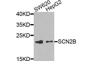 Western blot analysis of extracts of SW620 and HepG2 cells, using SCN2B antibody. (SCN2B anticorps)