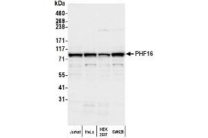 anti-PHD Finger Protein 16 (PHF16) (AA 773-823) antibody