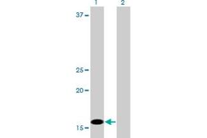 Western Blot analysis of C1D expression in transfected 293T cell line by C1D monoclonal antibody (M03), clone 6H2.