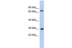AKTIP antibody used at 1 ug/ml to detect target protein. (AKTIP anticorps  (Middle Region))