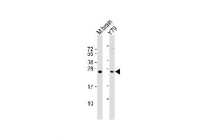 Western Blot at 1:1000-1:2000 dilution Lane 1: mouse brain lysate Lane 2: Y79 whole cell lysate Lysates/proteins at 20 ug per lane. (VKORC1L1 anticorps  (N-Term))