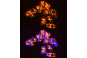 Immunofluorescence analysis of HepG2 cells using [KO Validated]  Rabbit mAb (ABIN7265466) at dilution of 1:25 (40x lens). (Adenylate Kinase 2 anticorps)
