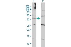 Western Blot analysis of CCNK expression in transfected 293T cell line by CCNK monoclonal antibody (M01), clone 3B7-1B9. (Cyclin K anticorps  (AA 1-354))
