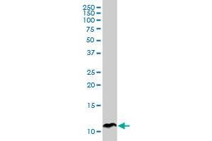 SPINK1 monoclonal antibody (M01), clone 4D4.