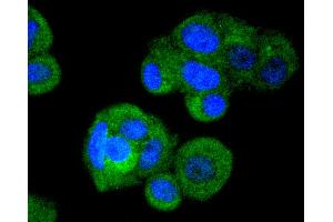 MCF-7 cells were stained with IRF3 (4C3) Monoclonal Antibody  at [1:200] incubated overnight at 4C, followed by secondary antibody incubation, DAPI staining of the nuclei and detection. (IRF3 anticorps)
