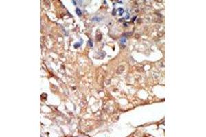Image no. 2 for anti-V-Raf-1 Murine Leukemia Viral Oncogene Homolog 1 (RAF1) (N-Term) antibody (ABIN360145) (RAF1 anticorps  (N-Term))
