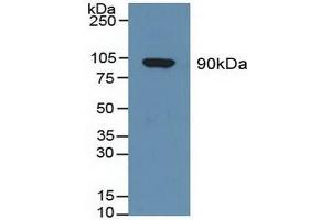 Detection of GSN in Human Serum using Polyclonal Antibody to Gelsolin (GSN) (Gelsolin anticorps  (AA 674-782))