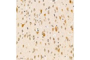 Immunohistochemistry of paraffin embedded rat brain using B3GALT4 (ABIN7076137) at dilution of 1:400 (300x lens)
