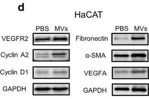Effect of ASC-MV treatment on gene expression in all three kinds of cells.