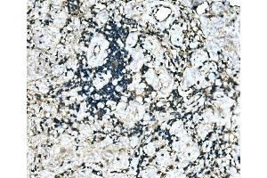 IHC analysis of MEF2B using anti-MEF2B antibody (ABIN7599892).