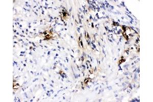 IHC analysis of Mast Cell Tryptase using anti-Mast Cell Tryptase antibody (ABIN4886754).