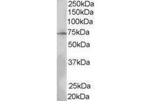 Western Blotting (WB) image for anti-SH2B Adaptor Protein 3 (SH2B3) (N-Term) antibody (ABIN2475350)