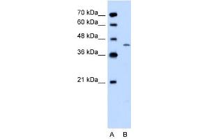 DHODH antibody used at 0. (DHODH anticorps  (C-Term))