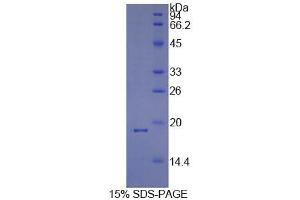 SDS-PAGE analysis of Human Cyclophilin A Protein. (PPIA Protéine)