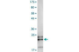 Western Blotting (WB) image for Tumor Necrosis Factor Receptor Superfamily, Member 13B (TNFRSF13B) (AA 2-165) protein (His-DYKDDDDK-Strep II Tag) (ABIN4369892)