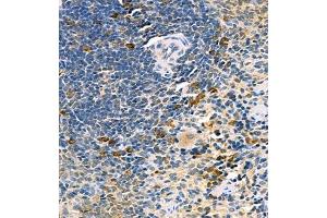 Immunohistochemistry of paraffin embedded rat spleen using UBE2J1 (ABIN7076117) at dilution of 1:400 (400x lens)