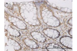anti-Rhophilin Associated Tail Protein 1 (ROPN1) (AA 1-120) antibody