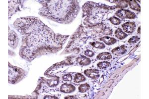 IHC analysis of MED18 using anti-MED18 antibody . (MED18 anticorps  (AA 1-208))