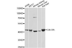 Western blot analysis of extracts of various cell lines, using CALCRL antibody. (CALCRL anticorps  (AA 392-461))
