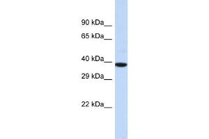 Host:  Rabbit  Target Name:  NOX4  Sample Type:  MCF7 Whole Cell lysates  Antibody Dilution:  1. (NADPH Oxidase 4 anticorps  (Middle Region))
