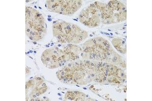 Immunohistochemistry of paraffin-embedded human stomach using MTERFD3 antibody (ABIN5974877) at dilution of 1/100 (40x lens). (MTERFD3 anticorps)