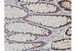 Image no. 1 for anti-WNK Lysine Deficient Protein Kinase 2 (WNK2) (AA 2118-2218) antibody (ABIN599299) (WNK2 anticorps  (AA 2118-2218))