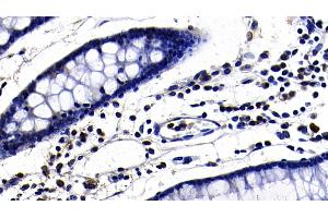 Detection of TLR3 in Porcine Colon Tissue using Polyclonal Antibody to Toll Like Receptor 3 (TLR3)