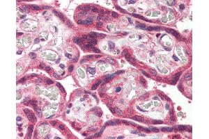 Anti-MLEC antibody IHC of human placenta.