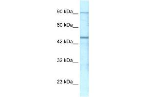 Host:  Rabbit  Target Name:  GBRP  Sample Type:  Jurkat Whole Cell lysates  Antibody Dilution:  0.
