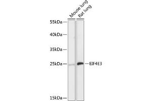 Western blot analysis of extracts of various cell lines, using EIF4E3 antibody (ABIN6130367, ABIN6140088, ABIN6140089 and ABIN6218034) at 1:3000 dilution. (EIF4E3 anticorps  (AA 1-118))