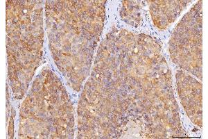 IHC analysis of Sorbitol Dehydrogenase/SORD using anti-Sorbitol Dehydrogenase/SORD antibody (ABIN7602485).