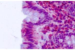 Anti-CELSR2 antibody IHC staining of human colon, epithelium.