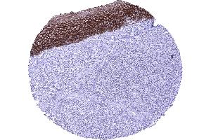 Tonsil surface epithelium A strong membranous and cytoplasmic TRIM29 immunostaining is seen in squamous epithelial cells of the tonsil surface