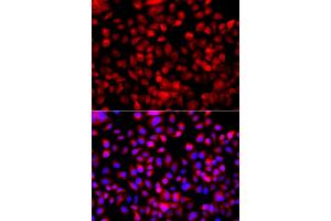 Immunofluorescence analysis of A549 cells using FASN antibody. (Fatty Acid Synthase anticorps)