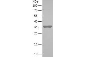 Western Blotting (WB) image for Peroxiredoxin 5 (PRDX5) (AA 102-214) protein (His-IF2DI Tag) (ABIN7124366) (Peroxiredoxin 5 Protein (PRDX5) (AA 102-214) (His-IF2DI Tag))