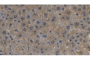 Detection of LRG1 in Rat Liver Tissue using Monoclonal Antibody to Leucine Rich Alpha-2-Glycoprotein 1 (LRG1) (LRG1 anticorps  (AA 39-308))