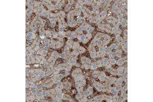 Immunohistochemical staining (Formalin-fixed paraffin-embedded sections) of human liver with ITIH4 monoclonal antibody, clone CL1858  shows immunoreactivity in sinusoids.