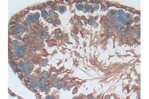 Detection of SELP in Rat Testis Tissue using Polyclonal Antibody to P-Selectin (SELP)