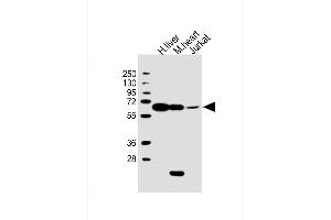 All lanes : Anti-PGM1 Antibody (C-Term) at 1:2000 dilution Lane 1: human liver lysate Lane 2: mouse heart lysate Lane 3: Jurkat whole cell lysate Lysates/proteins at 20 μg per lane. (Phosphoglucomutase 1 anticorps  (AA 469-501))