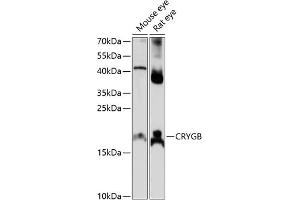 Western blot analysis of extracts of various cell lines, using CRYGB antibody (ABIN7266531) at 1:1000 dilution.