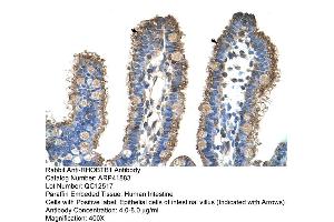 Rabbit Anti-RHOBTB1 Antibody  Paraffin Embedded Tissue: Human Intestine Cellular Data: Epithelial cells of intestinal villas Antibody Concentration: 4. (RHOBTB1 anticorps  (Middle Region))