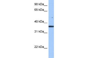 WB Suggested Anti-FAM153B Antibody Titration: 0. (FAM153B anticorps  (Middle Region))
