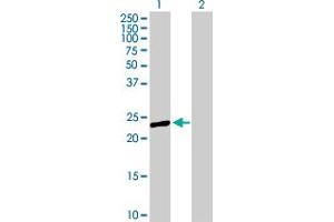Western Blot analysis of PRTFDC1 expression in transfected 293T cell line by PRTFDC1 MaxPab polyclonal antibody. (PRTFDC1 anticorps  (AA 1-225))