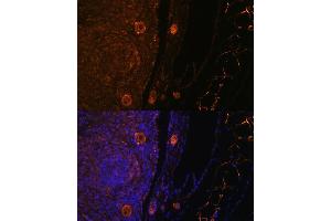 Immunofluorescence analysis of rat oophoroma cells using ZP3 antibody (ABIN6130818, ABIN6150537, ABIN6150539 and ABIN6224382) at dilution of 1:100.