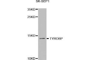 Western Blotting (WB) image for anti-TYRO Protein tyrosine Kinase Binding Protein (TYROBP) antibody (ABIN1876573) (TYROBP anticorps)