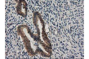 Image no. 5 for anti-Catenin (Cadherin-Associated Protein), beta 1, 88kDa (CTNNB1) antibody (ABIN1496888)