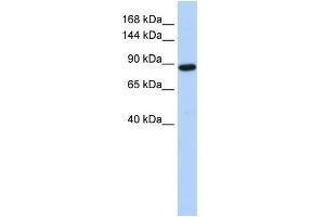 WB Suggested Anti-HACE1 Antibody Titration:  0. (HACE1 anticorps  (Middle Region))