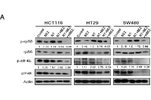BEZ235 maintenance treatment following RT + BEZ235 treatment sensitized CRC cells to radiation by attenuating mTOR signaling- and angiogenesis-associated molecules.